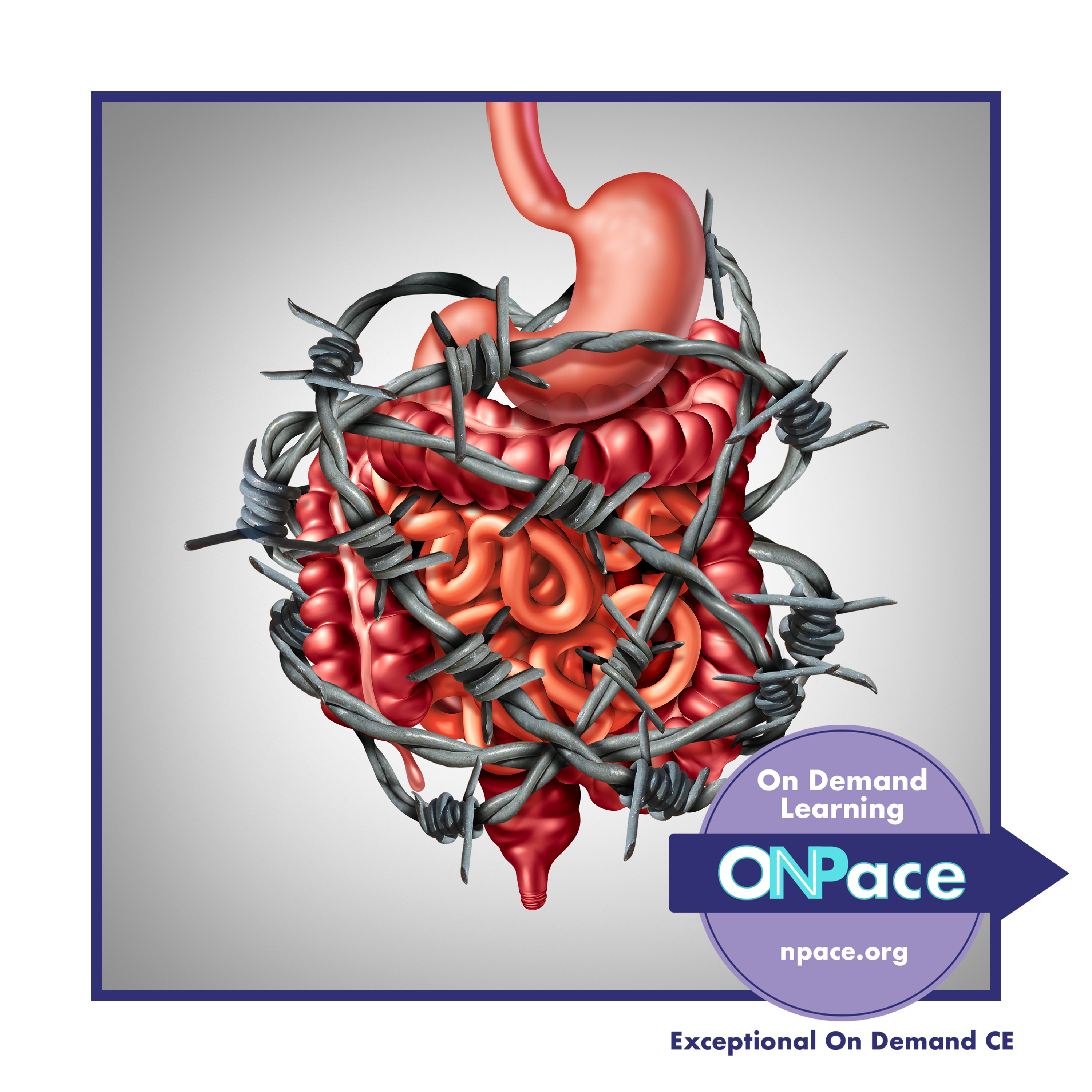 NPACE Functional Bowel Disorders: A Discussion of Heartburn, GERD, and IBS/Chronic Constipation