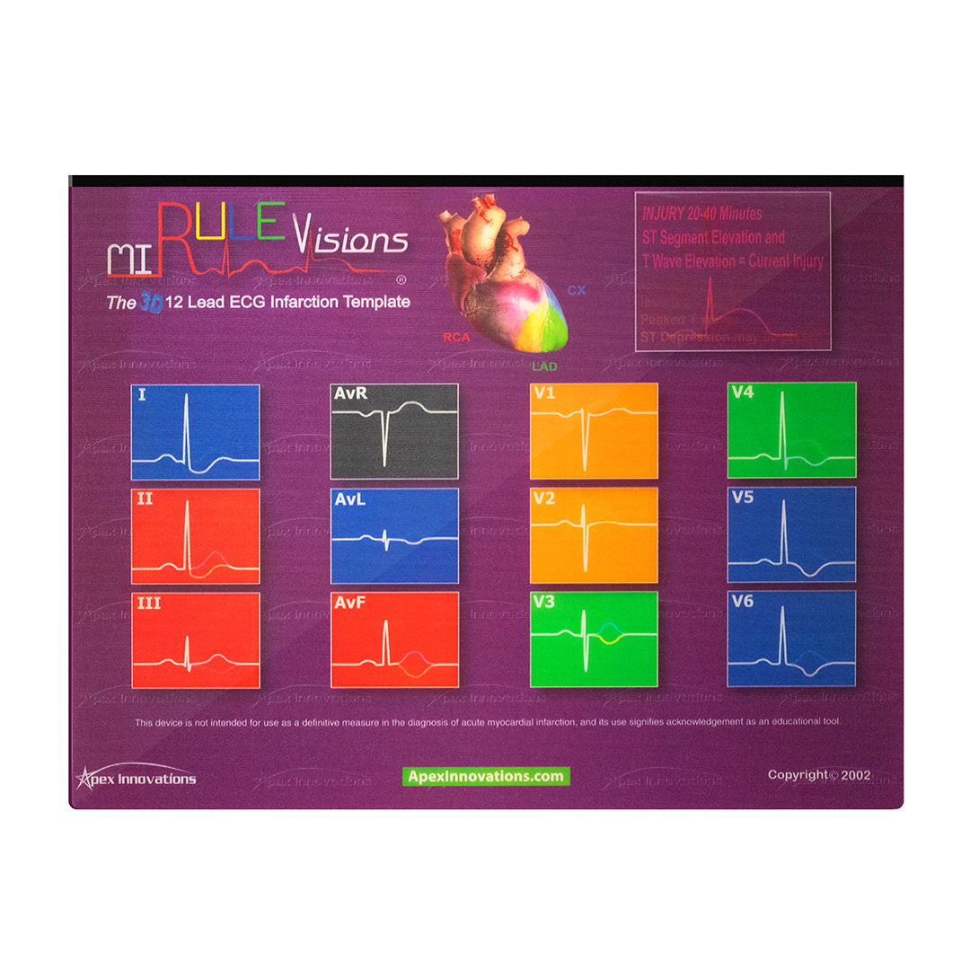 Live Discount Tool to Identify Myocardial Infarction