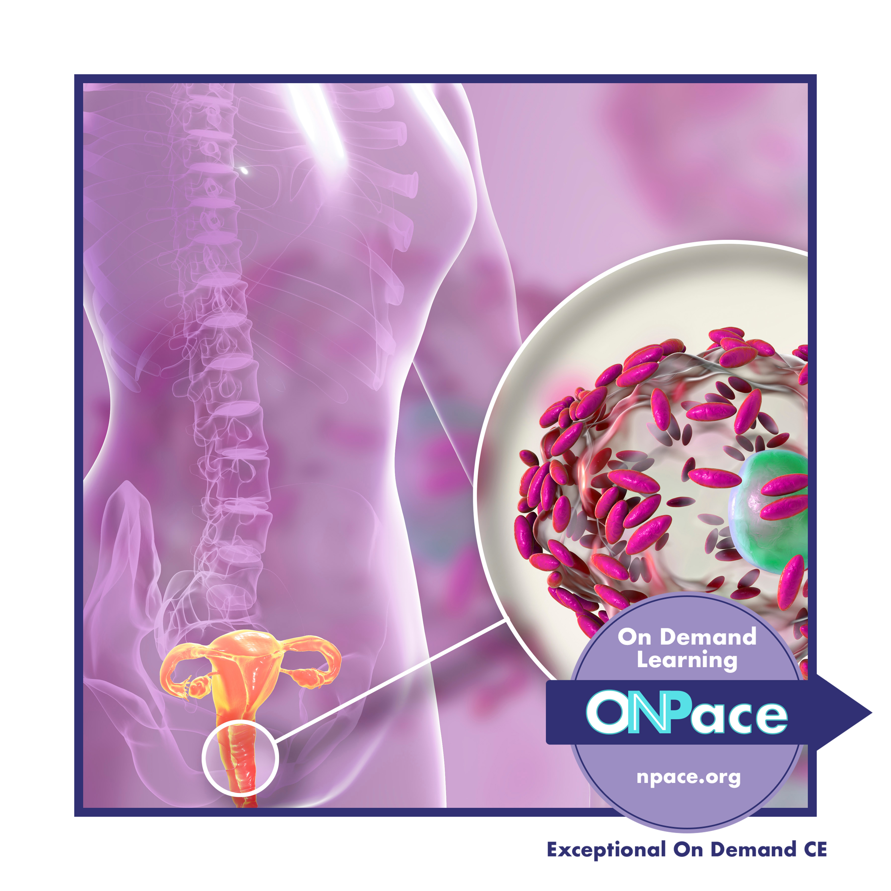NPACE Pharmacology for Vaginitis 