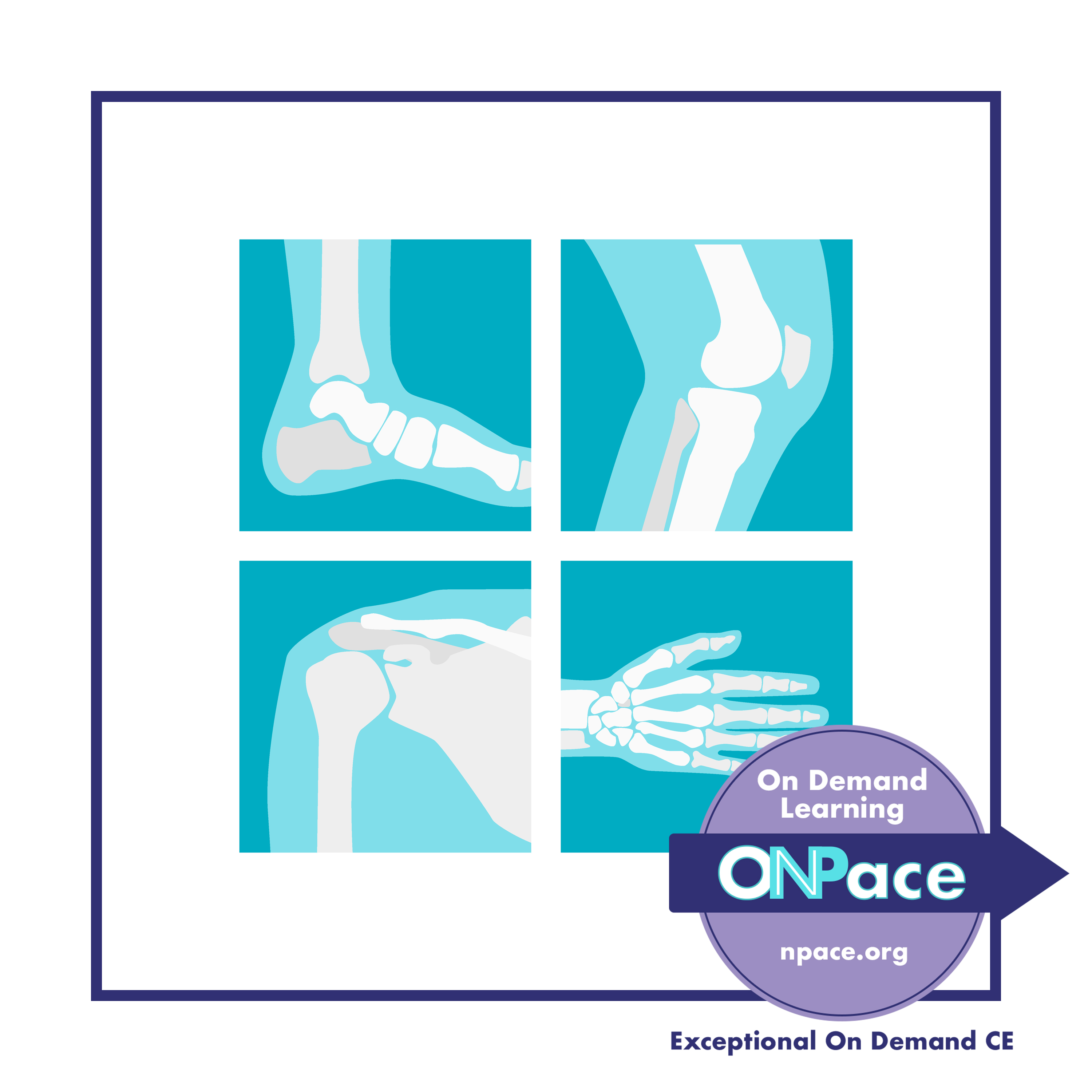 NPACE Pitfalls in Orthopedics for the Primary Care Practitioner   